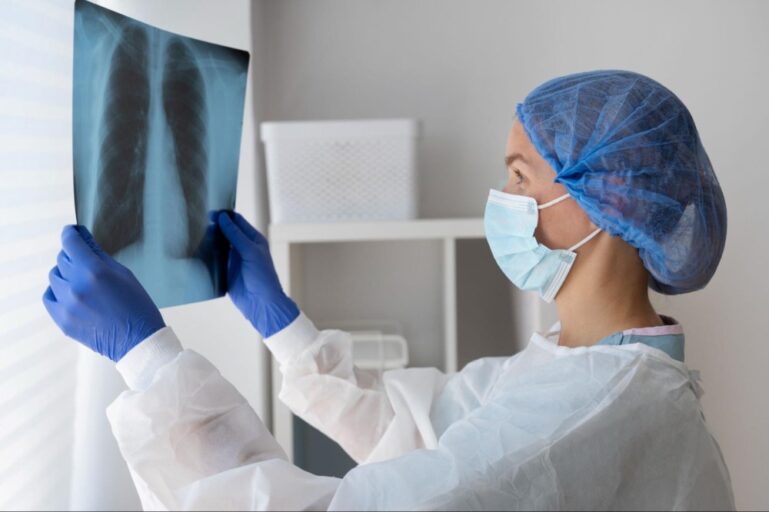Médica com EPI’s segurando uma chapa de raio-x de um pulmão.